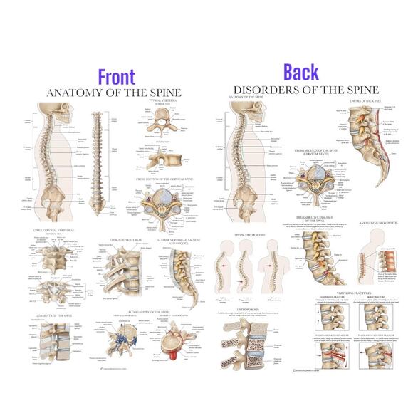 Laminated Anatomy Poster Disorders of the Spine Anatomy Poster - Picture 1 of 3